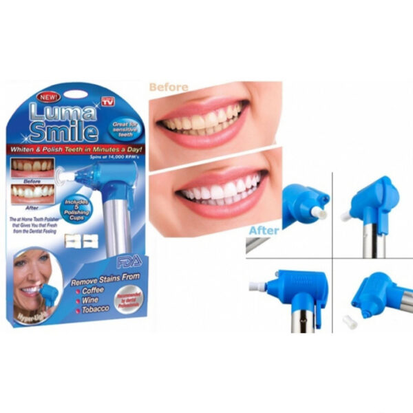 teeth whitening polisher stain remover